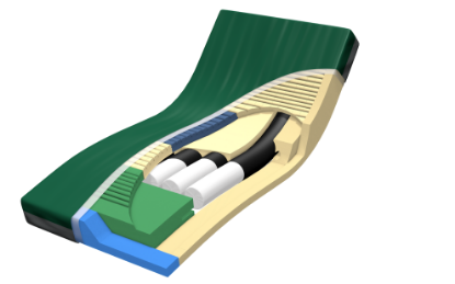 Picture of PressureGuard® Span-Care® Convertible
